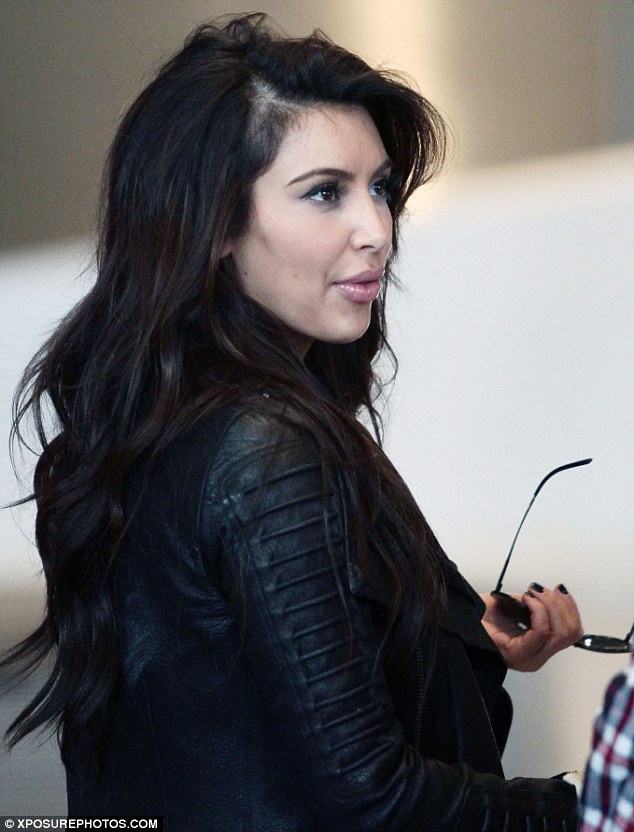 Kim Kardashian Hair Loss and Bald Spots? | Hair Loss Q &amp; A