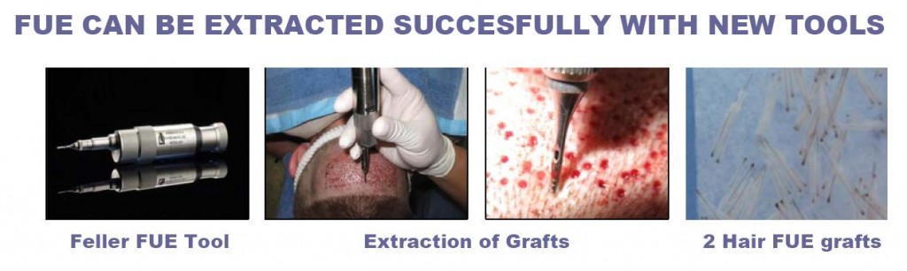 fue_extraction2