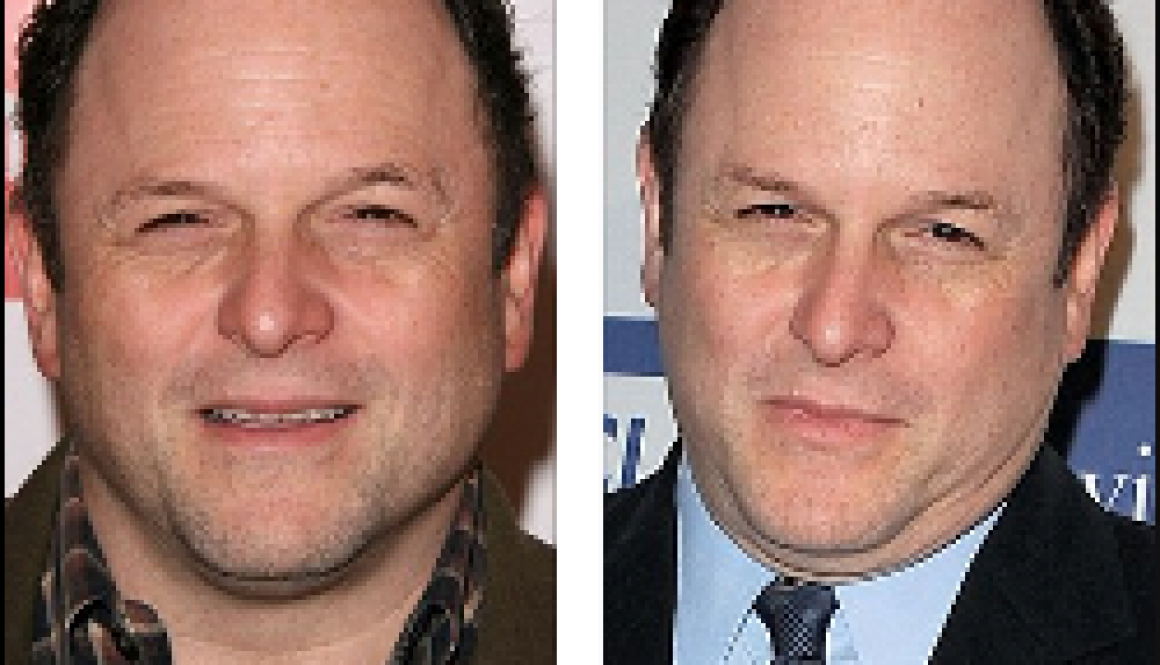 Seinfeld Star Jason Alexander Admits to Hiding Hair Loss with a “Hair Piece”