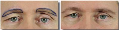 Eyebrow