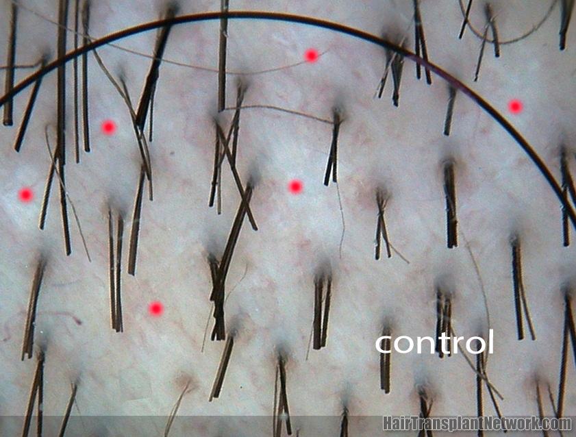 control 2yrs copy