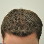 MB_5Months_Overheada