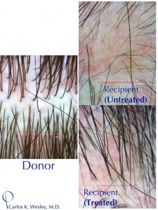 FullJL_DonorRecipientEffect_small