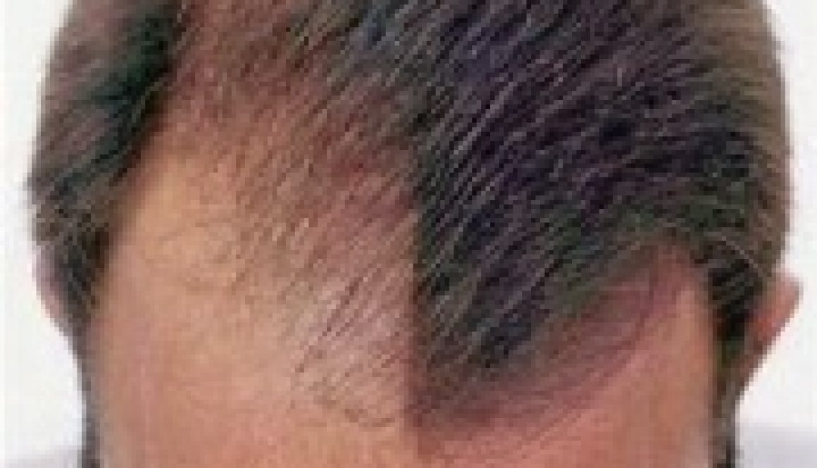concealer