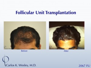 MA_Slide1