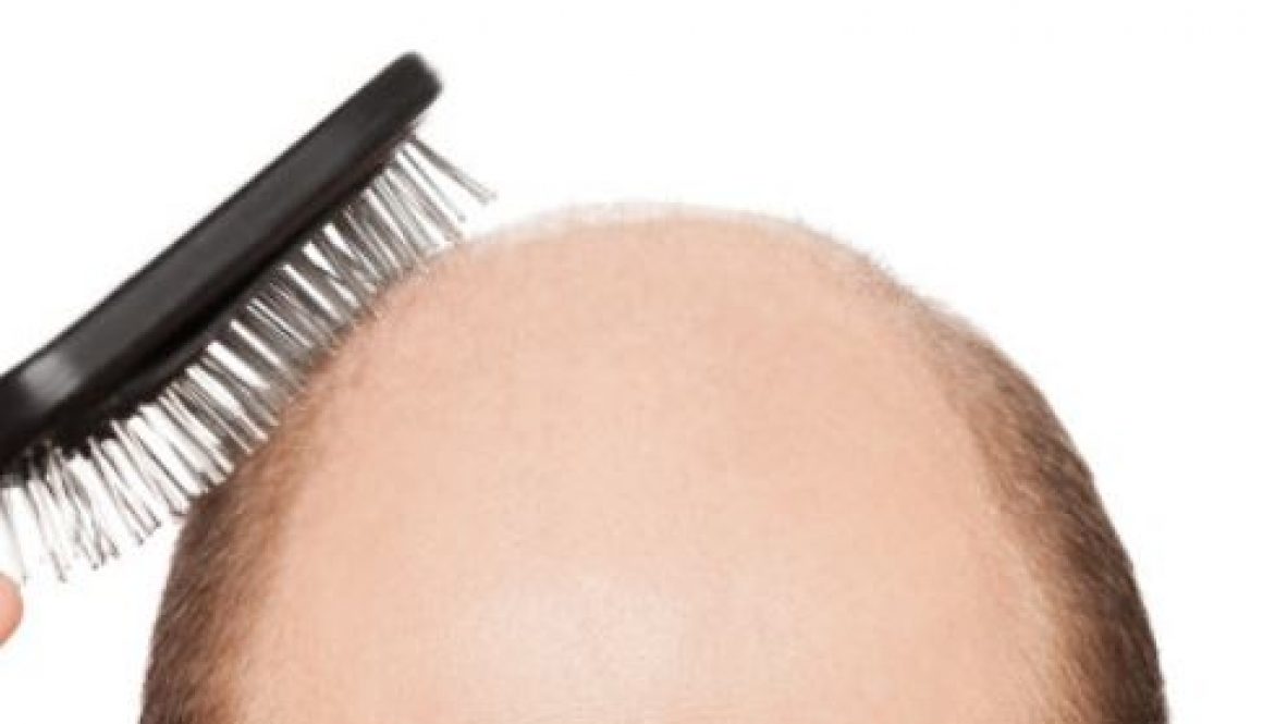 hair loss
