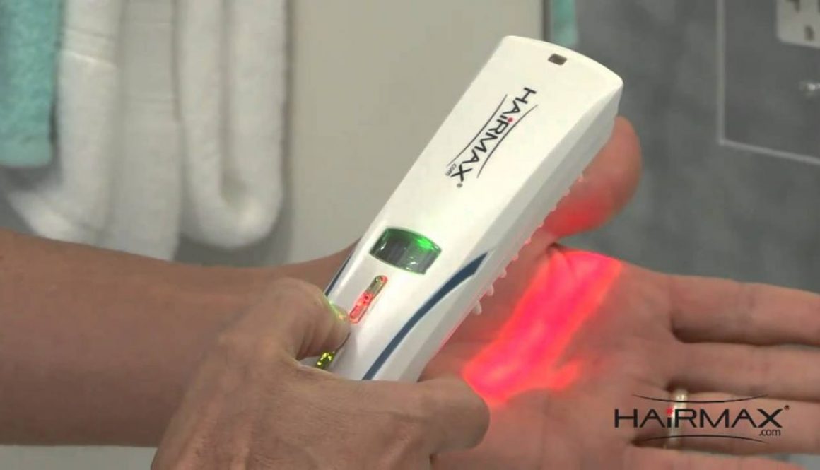 What Patients are Saying about the HairMax Lasercomb and Laser Therapy (LLLT)