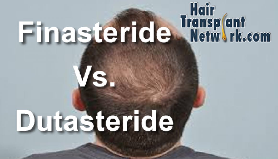 Using Finasteride and Dutasteride Together to Treat Hair Loss?