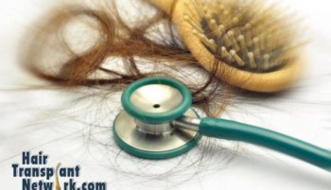 Recently Experiencing Excessive and Rapid Hair Loss – What is Causing This and How Can I Stop Hair Loss?