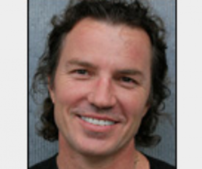 How Do I Get the Best Crown Hair Transplant?