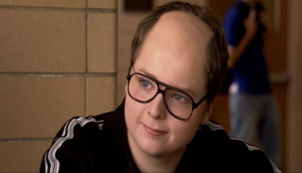 Am I Too Young For A Hair Transplant?