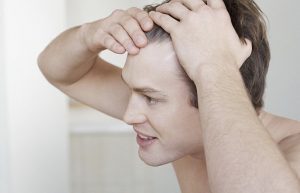 What Happens If I Get A Hair Transplant, But Keep Losing Hair?