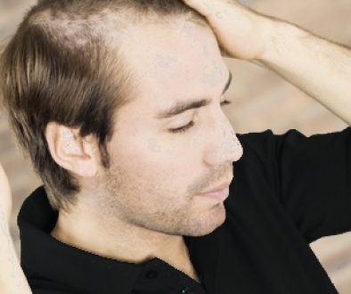 What Can My Young Boyfriend Do About His Hair Loss