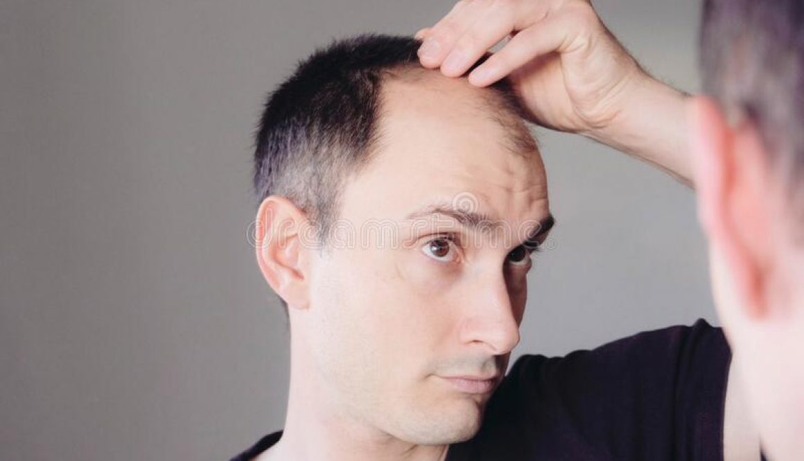 Five Months and No Growth Did My Hair Transplant Fail?