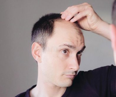 Five Months and No Growth Did My Hair Transplant Fail?