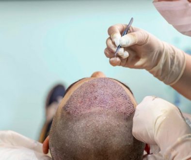 What is the Future of the Hair Transplant Industry in the Next Ten Years